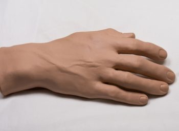 Prosthetic Hand